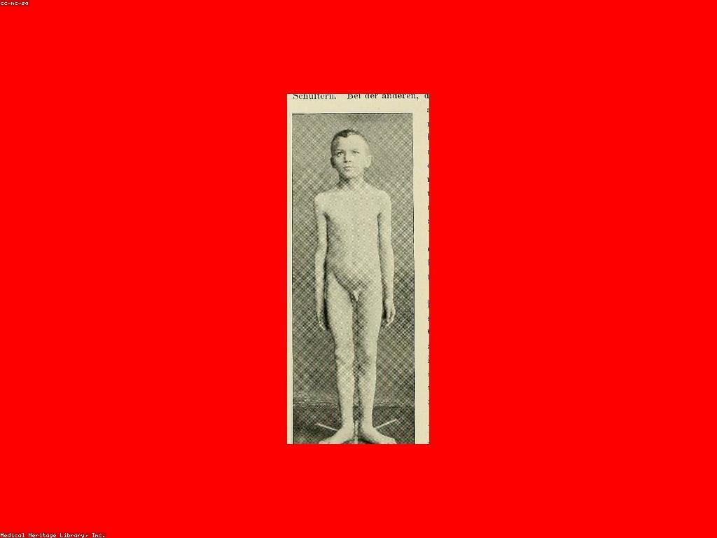 រង្វាន់ និងអត្ថប្រយោជន៍សម្រាប់កំណើនផ្ទាល់ខ្លួន